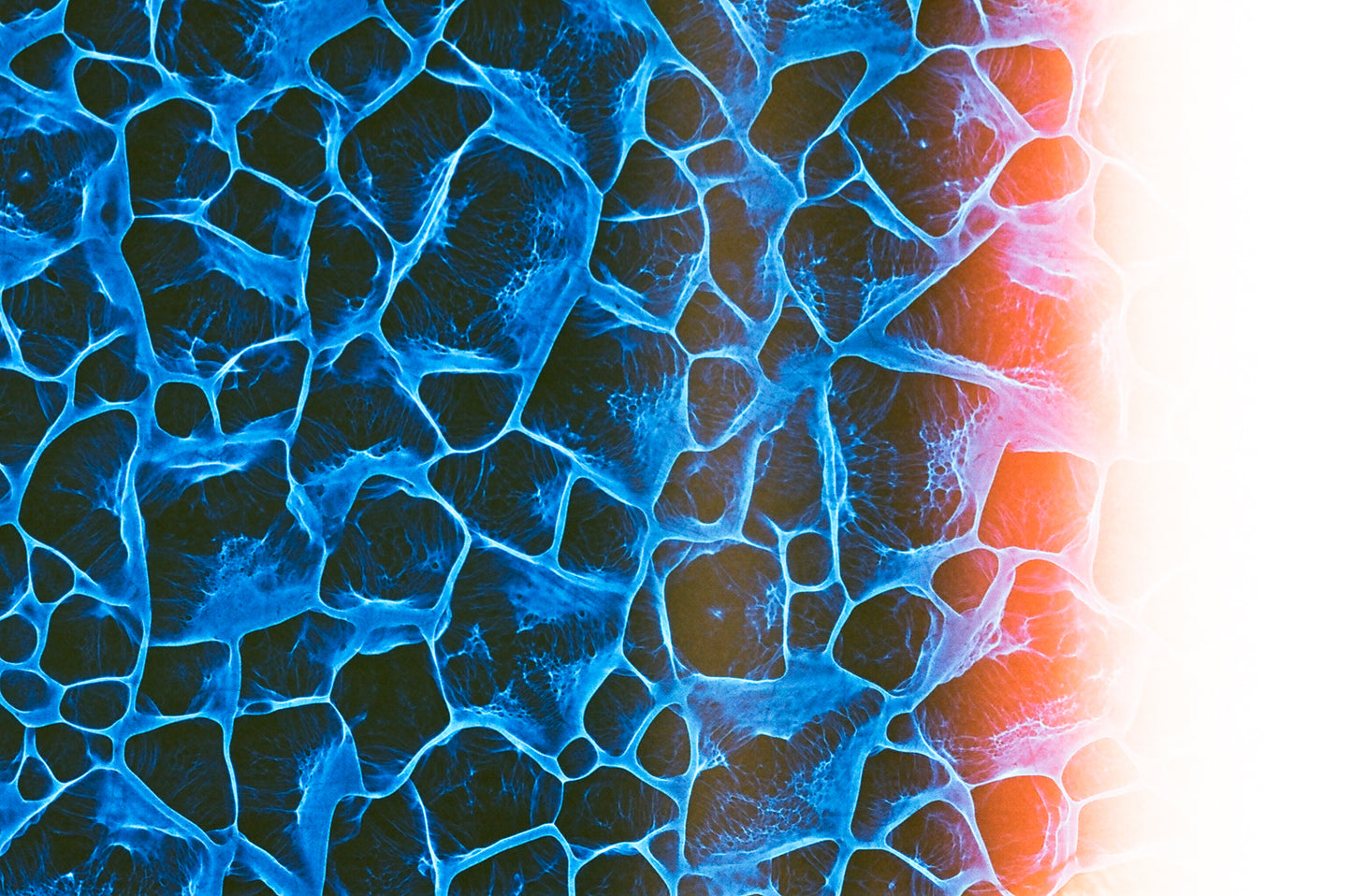 Plexus - Film Original - 35mm