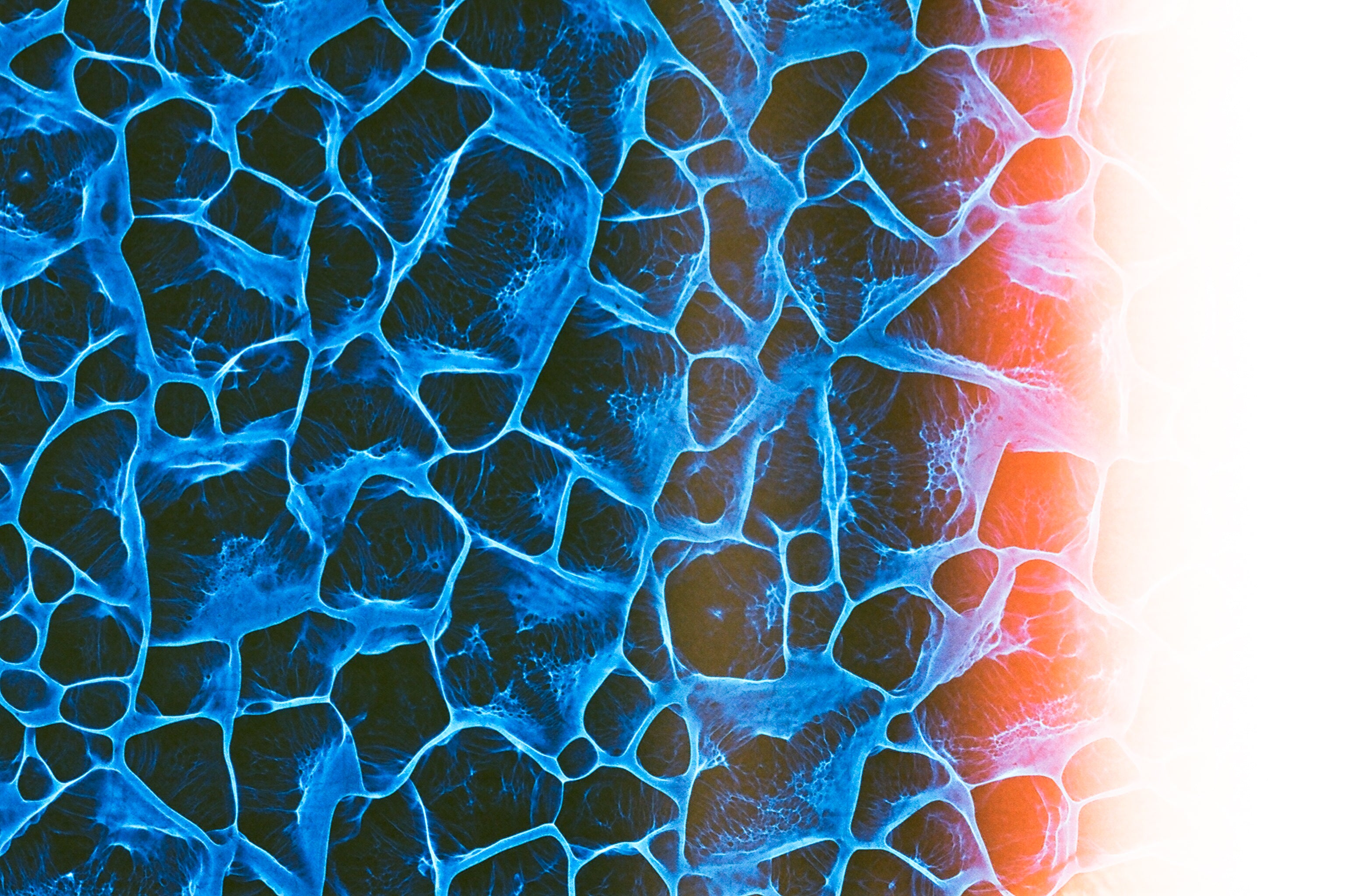 Plexus - Film Original - 35mm